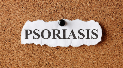 Psoriasis: Understanding and Managing the Chronic Skin Condition